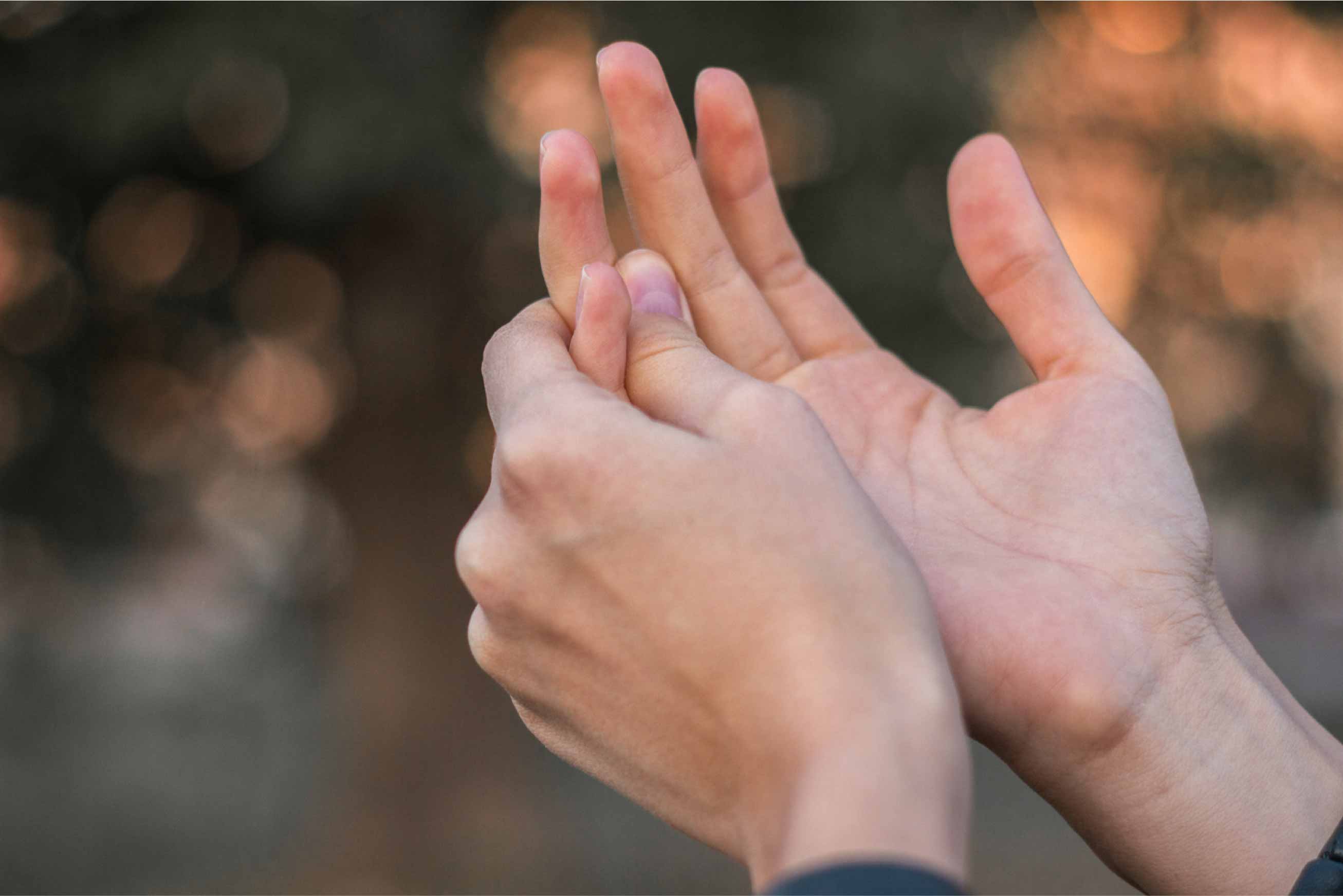 La homeopatía en el tratamiento del síndrome de Raynaud