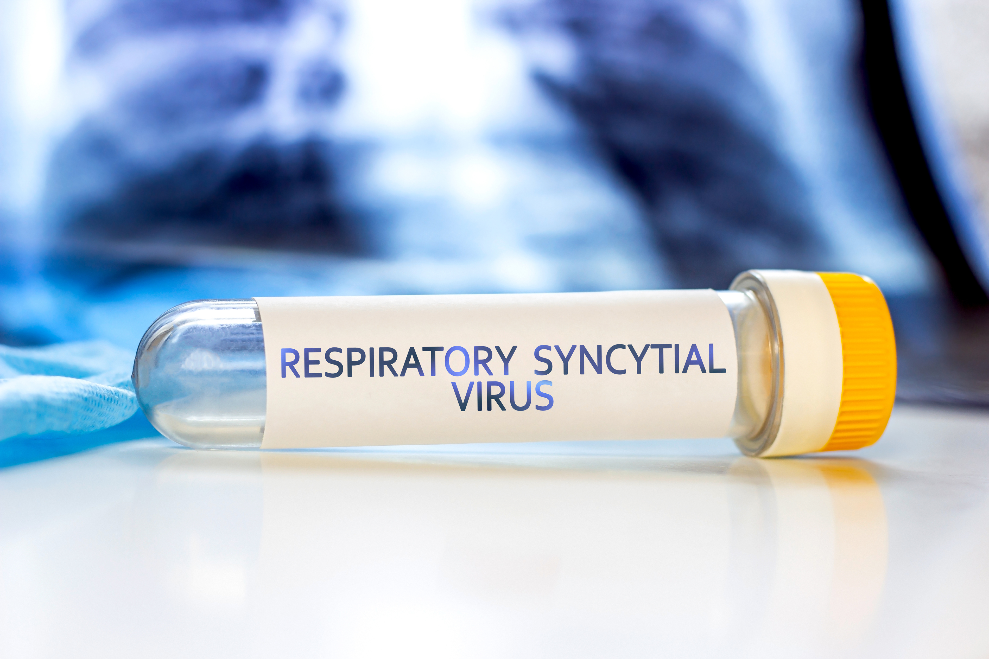 Respiratory Syncytial Virus with lung ct scan aside on light blue background. RSV disease concept.